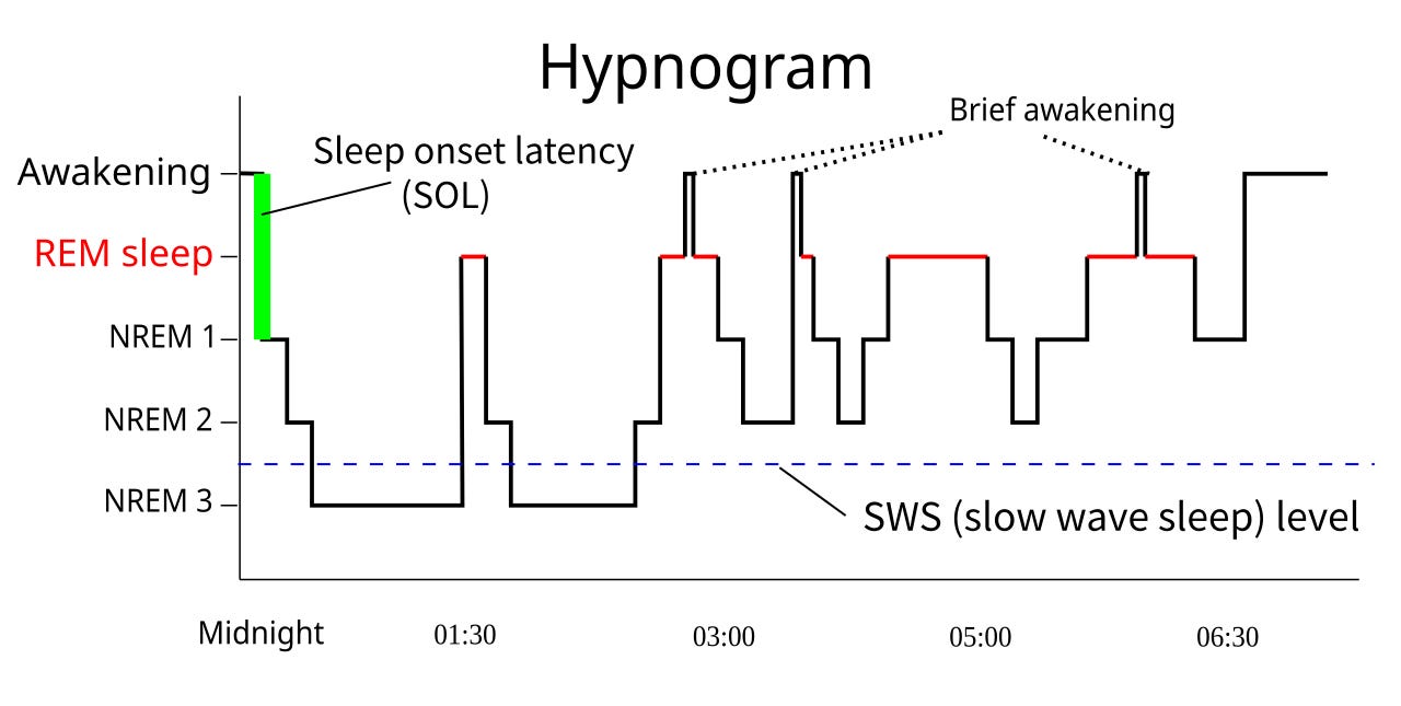 Typical sleep hypnogram (source: Wikipedia)